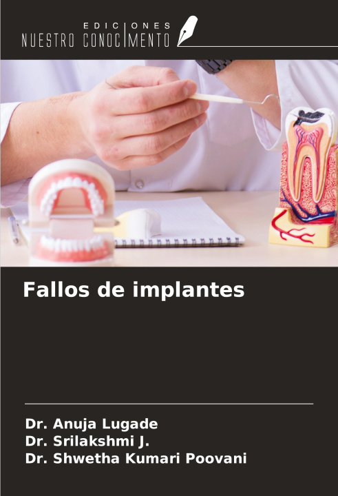 Knjiga Fallos de implantes Srilakshmi J.