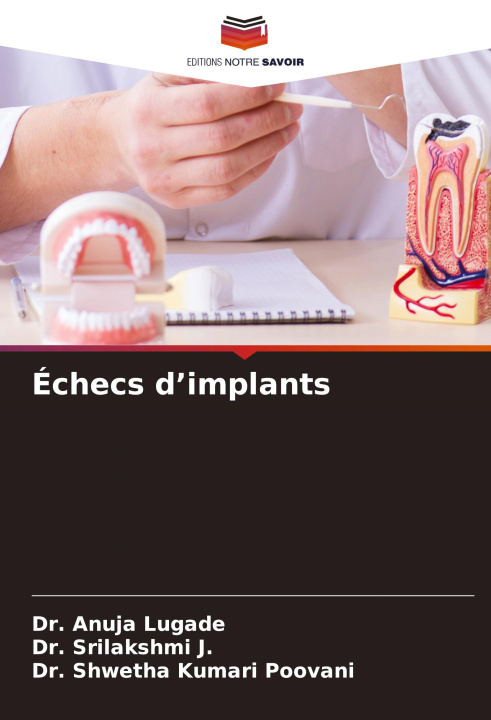 Knjiga Échecs d?implants Srilakshmi J.