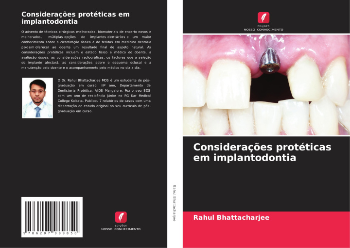 Boek Consideraç?es protéticas em implantodontia Rahul Bhattacharjee