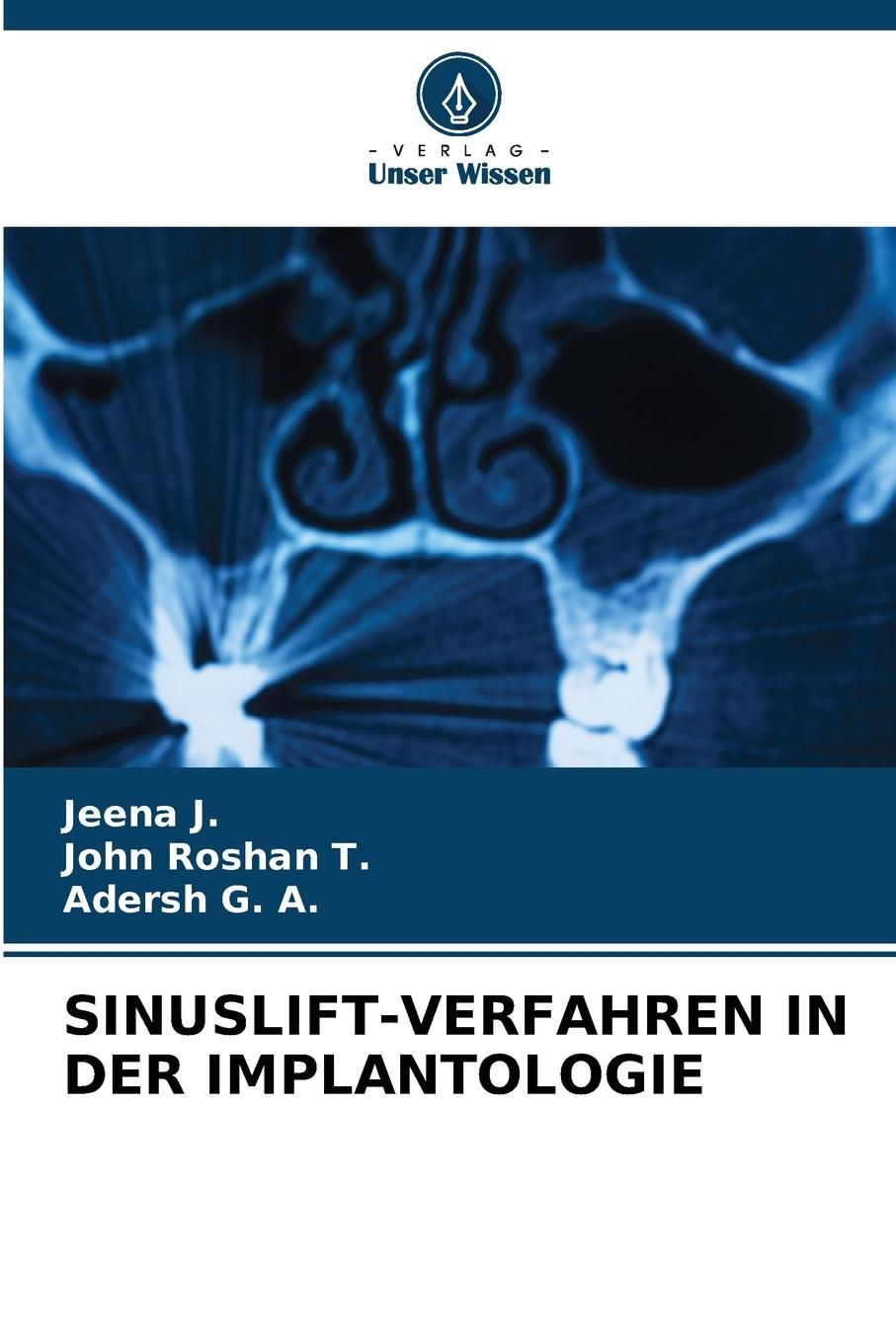 Boek SINUSLIFT-VERFAHREN IN DER IMPLANTOLOGIE John Roshan T.