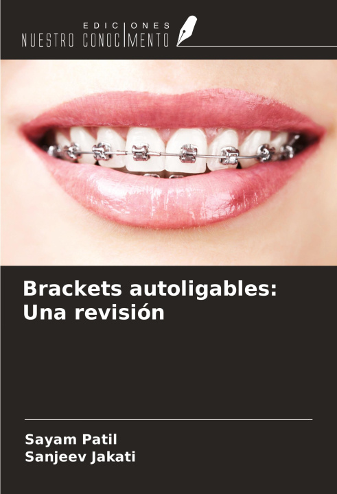 Boek Brackets autoligables: Una revisión Sanjeev Jakati