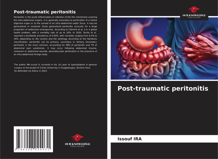 Knjiga Post-traumatic peritonitis Issouf IRA