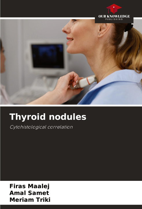 Knjiga Thyroid nodules Amal Samet