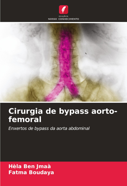 Libro Cirurgia de bypass aorto-femoral Fatma Boudaya