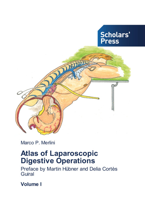 Knjiga Atlas of Laparoscopic Digestive Operations Marco P. Merlini