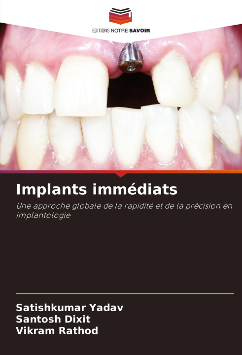 Knjiga Implants immédiats Santosh Dixit