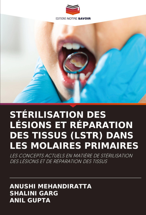 Boek STÉRILISATION DES LÉSIONS ET RÉPARATION DES TISSUS (LSTR) DANS LES MOLAIRES PRIMAIRES Shalini Garg
