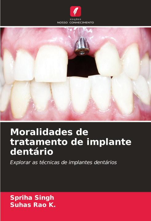 Knjiga Moralidades de tratamento de implante dentário Suhas Rao K.
