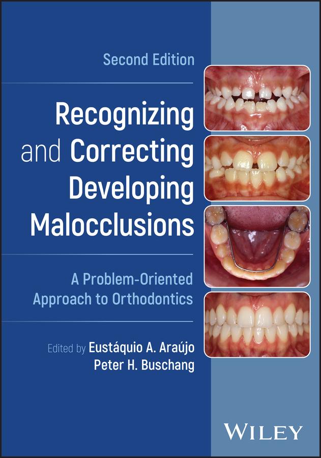 Book Recognizing and Correcting Developing Malocclusion s: A Problem-Oriented Approach to Orthodontics, Se cond Edition Peter H Buschang