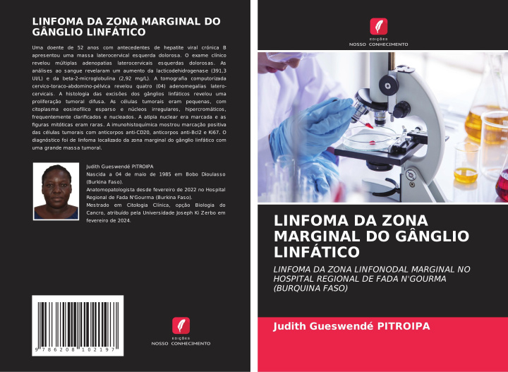 Knjiga LINFOMA DA ZONA MARGINAL DO GÂNGLIO LINFÁTICO Judith Gueswendé PITROIPA
