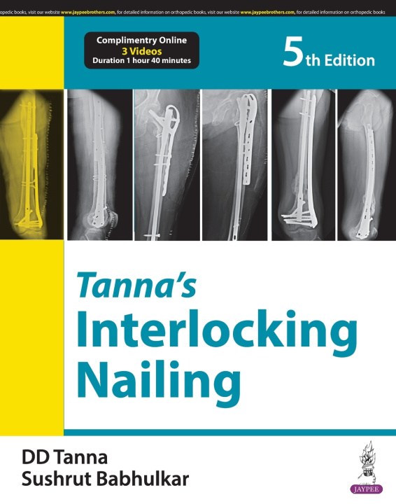 Livro Tanna’s Interlocking Nailing DD Tanna