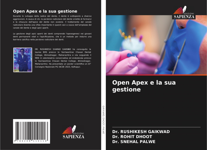 Książka Open Apex e la sua gestione Rohit Dhoot