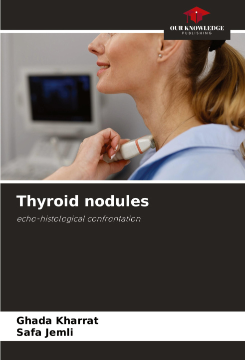 Buch Thyroid nodules Safa Jemli