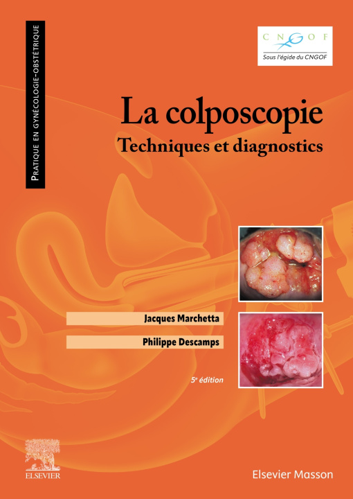 Buch La colposcopie Jacques Marchetta