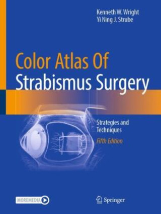 Kniha Color Atlas Of Strabismus Surgery Kenneth W. Wright