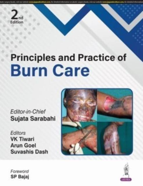Buch Principles and Practice of Burn Care Sujata Sarabahi