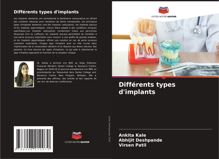 Knjiga Différents types d'implants Ankita Kale