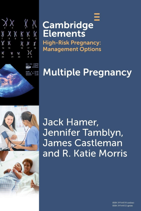 Książka Multiple Pregnancy Jack (Birmingham Women's and Children's NHS) Hamer