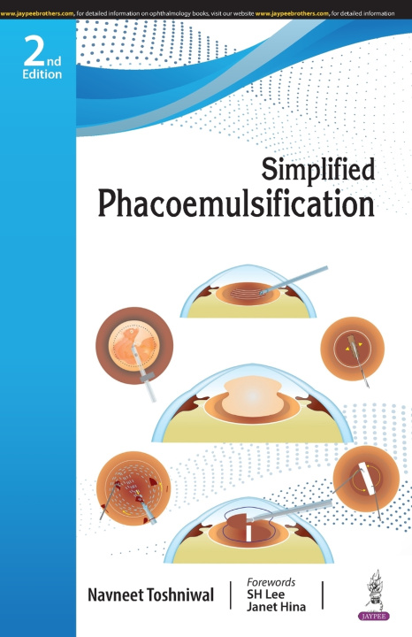 Knjiga Simplified Phacoemulsification Navneet Toshniwal
