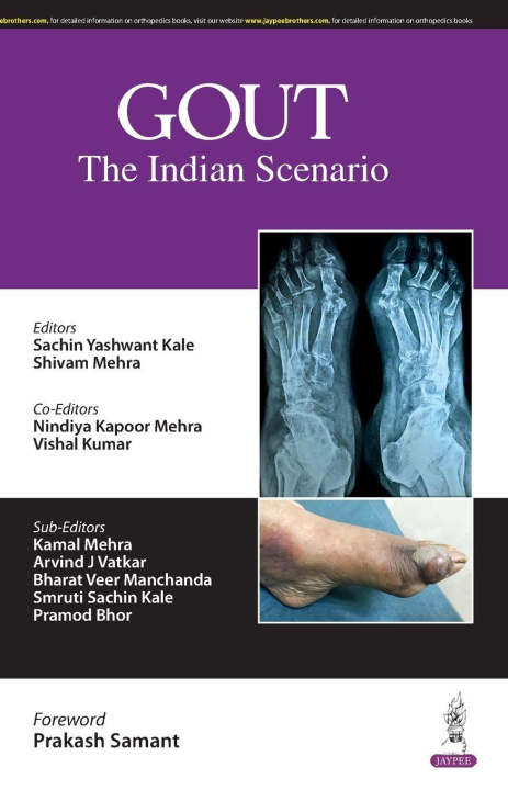 Knjiga Gout Sachin Yashwant Kale