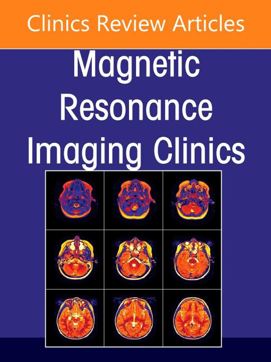 Buch Spine Imaging, an Issue of Magnetic Resonance Imaging Clinics of North America Roy Riascos