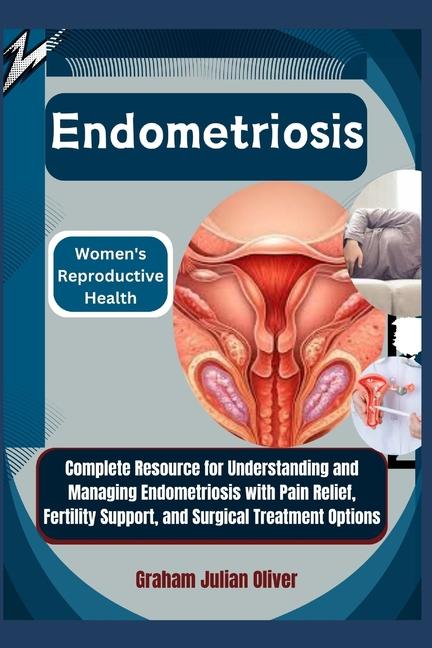 Knjiga Endometriosis Graham Julian Oliver