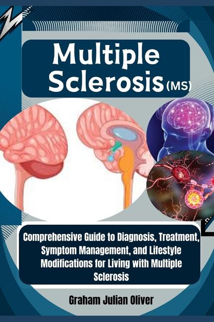 Knjiga Multiple Sclerosis (MS) Graham Julian Oliver