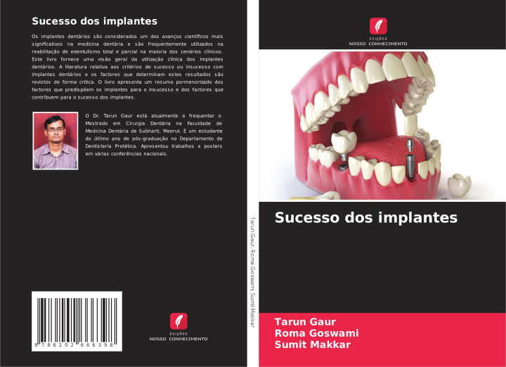 Knjiga Sucesso dos implantes Tarun Gaur