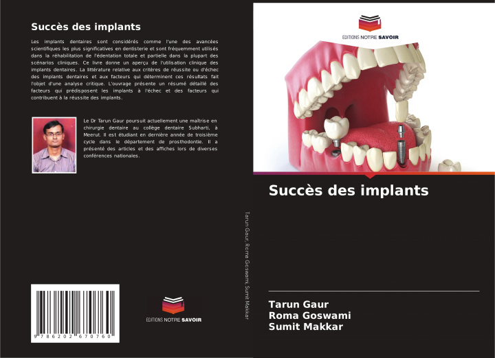 Book Succès des implants Tarun Gaur