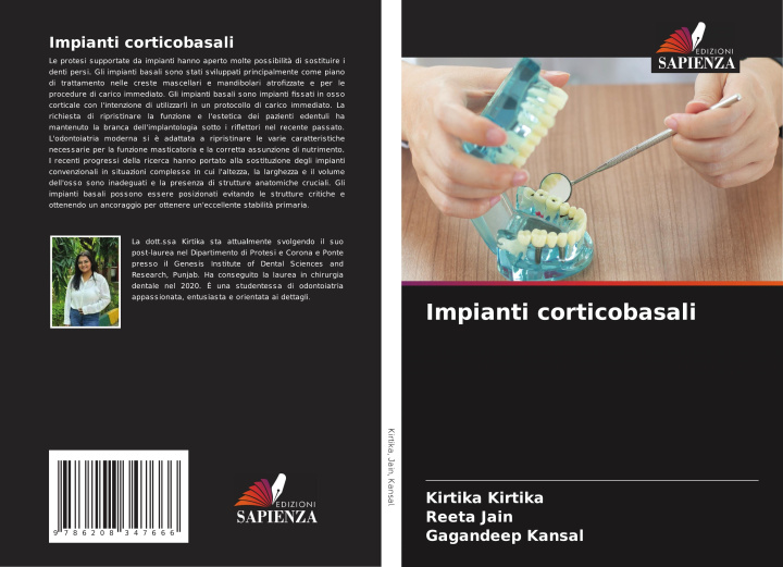 Kniha Impianti corticobasali Kirtika Kirtika