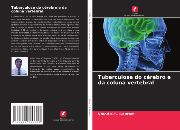 Knjiga Tuberculose do cérebro e da coluna vertebral Vinod K.S. Gautam