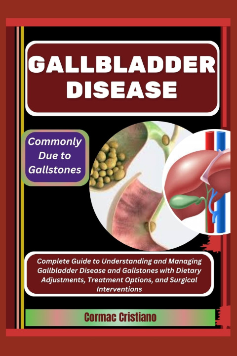 Knjiga Gallbladder Disease Cormac Cristiano