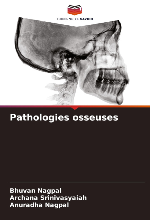 Book Pathologies osseuses Archana Srinivasyaiah