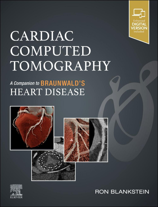 Книга Cardiac Computed Tomography Ron Blankstein