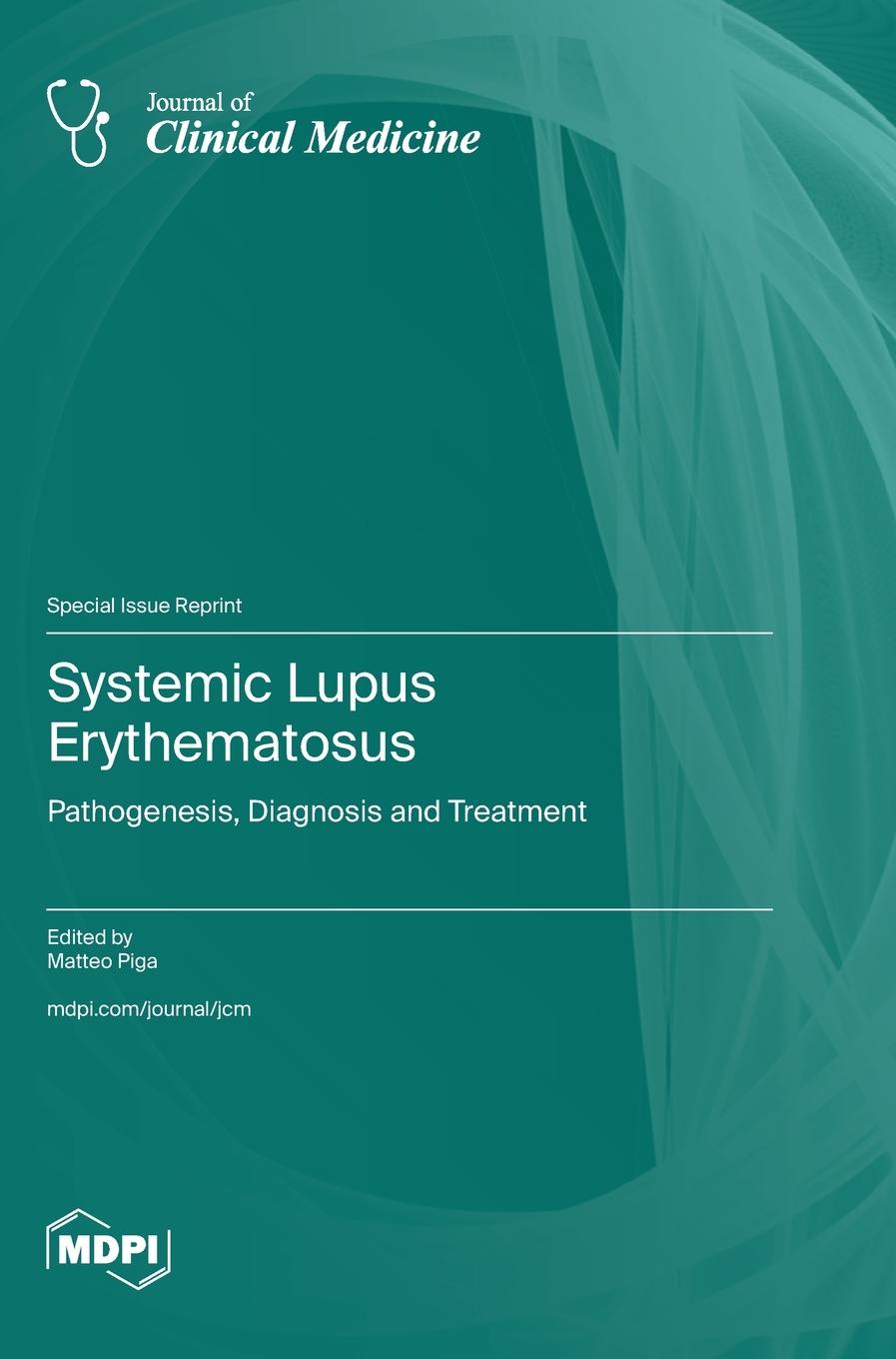 Knjiga Systemic Lupus Erythematosus Matteo Piga