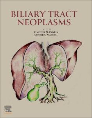 Boek Biliary Tract Neoplasms Timothy M. Pawlik