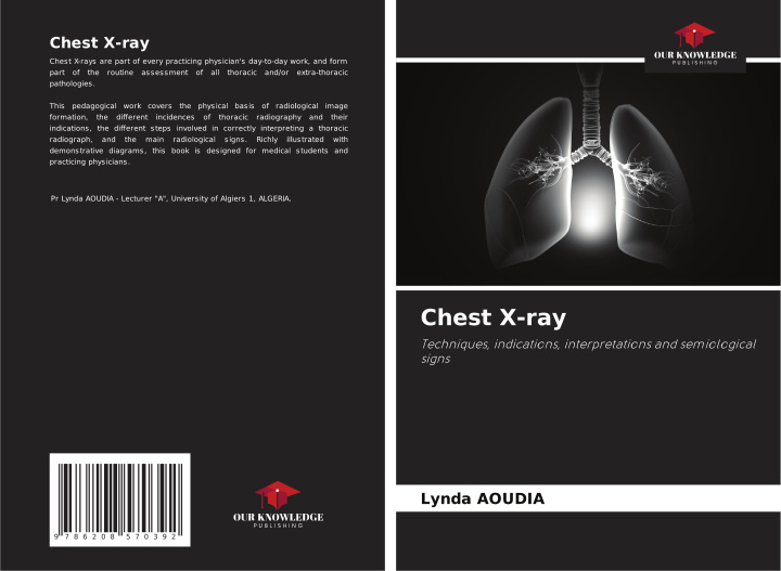 Knjiga Chest X-ray Lynda Aoudia