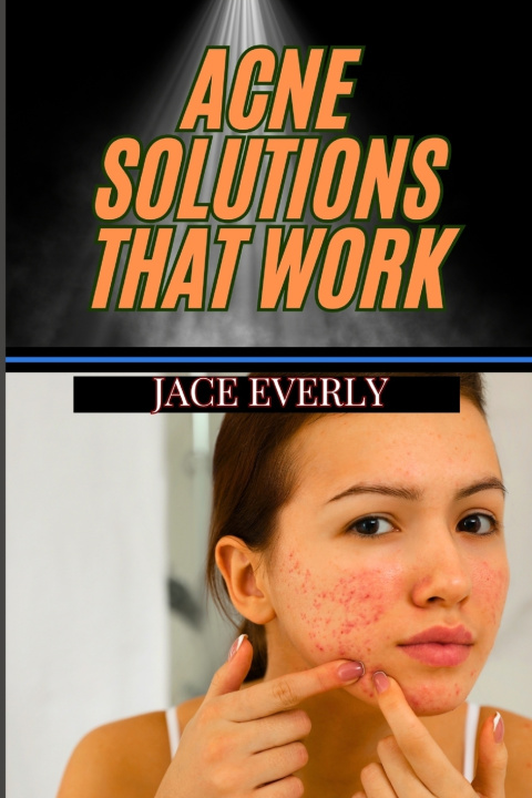 Kniha Acne Solutions That Work JACE EVERLY