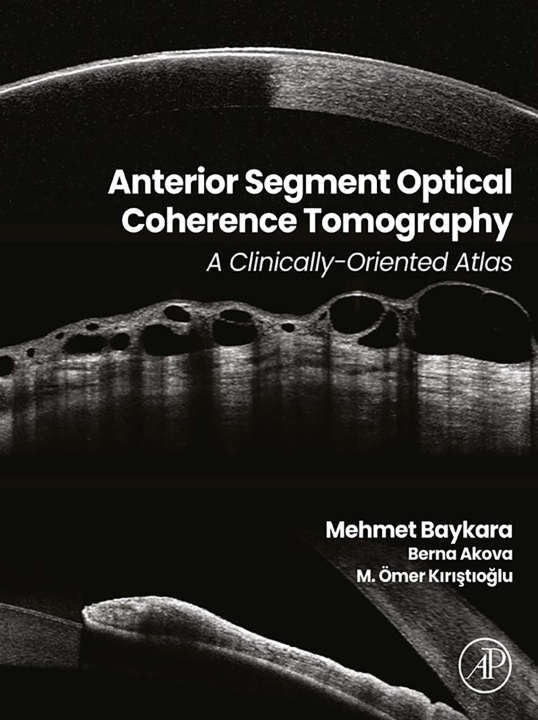 E-book Anterior Segment Optical Coherence Tomography Mehmet Baykara