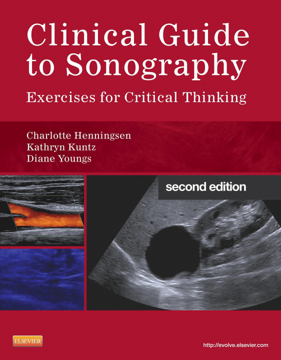 E-knjiga Clinical Guide to Sonography - E-Book Charlotte Henningsen