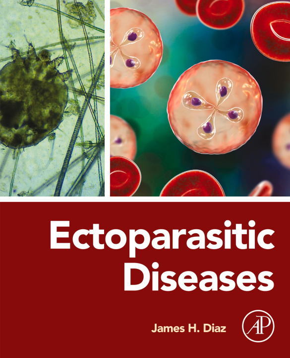 E-book Ectoparasitic Diseases James H. Diaz