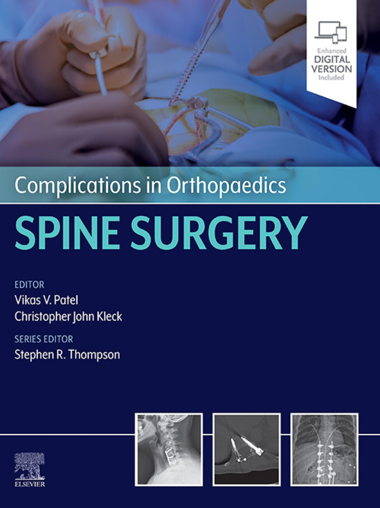 E-knjiga Complications in Orthopaedics: Spine Surgery - E-Book Vikas Patel