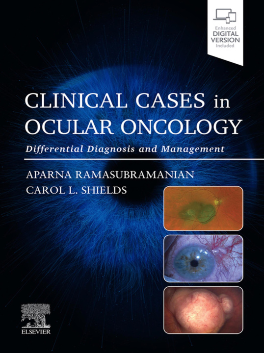 E-Book Clinical Cases in Ocular Oncology - E-BOOK Aparna Ramasubramanian