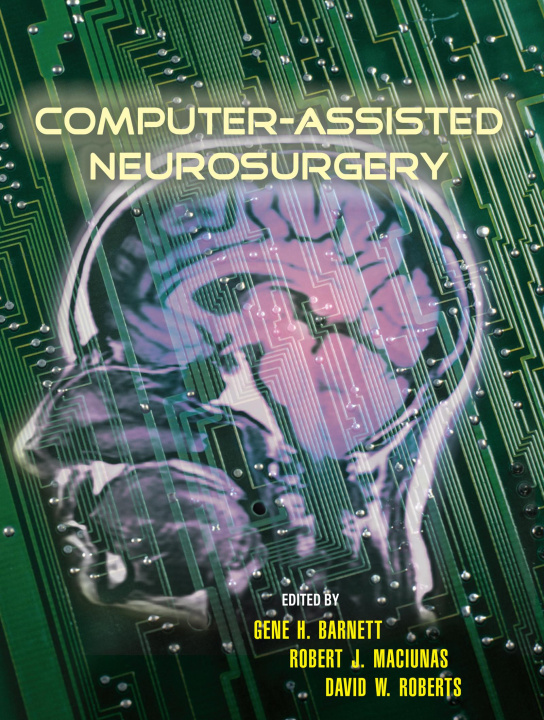 E-kniha Computer-Assisted Neurosurgery Gene H. Barnett