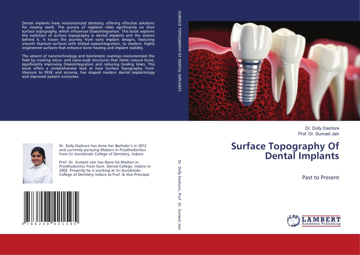 Książka Surface Topography Of Dental Implants Sumeet Jain
