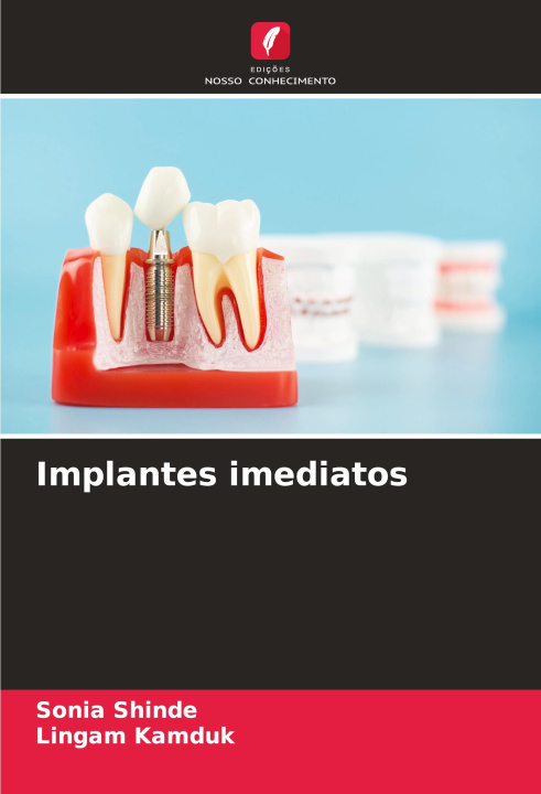 Kniha Implantes imediatos Lingam Kamduk