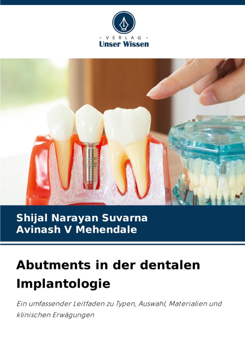 Kniha Abutments in der dentalen Implantologie Avinash V Mehendale