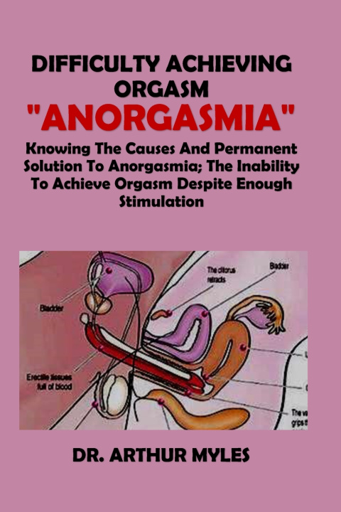 Knjiga Difficulty Achieving Orgasm "Anorgasmia" Dr. Arthur Myles