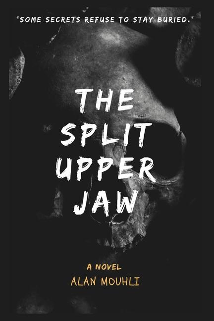 Knjiga he Split Upper Jaw Alan MOUHLI