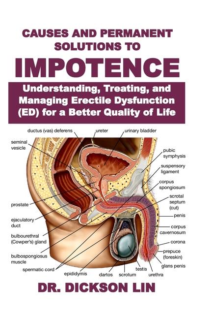 Kniha Causes and Permanent Solutions to Impotence Dr. Dickson Lin